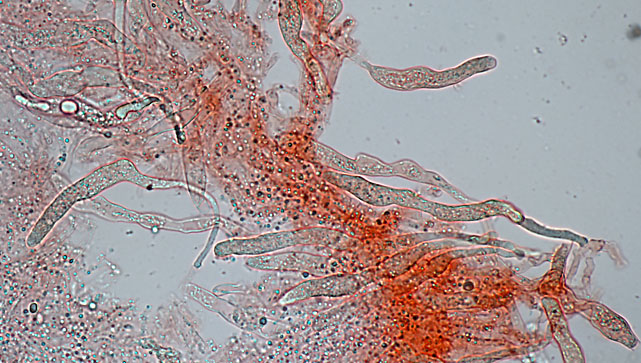 Gloeocystidiellum porosum